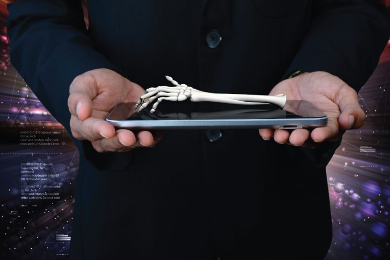 3D Printed Bone